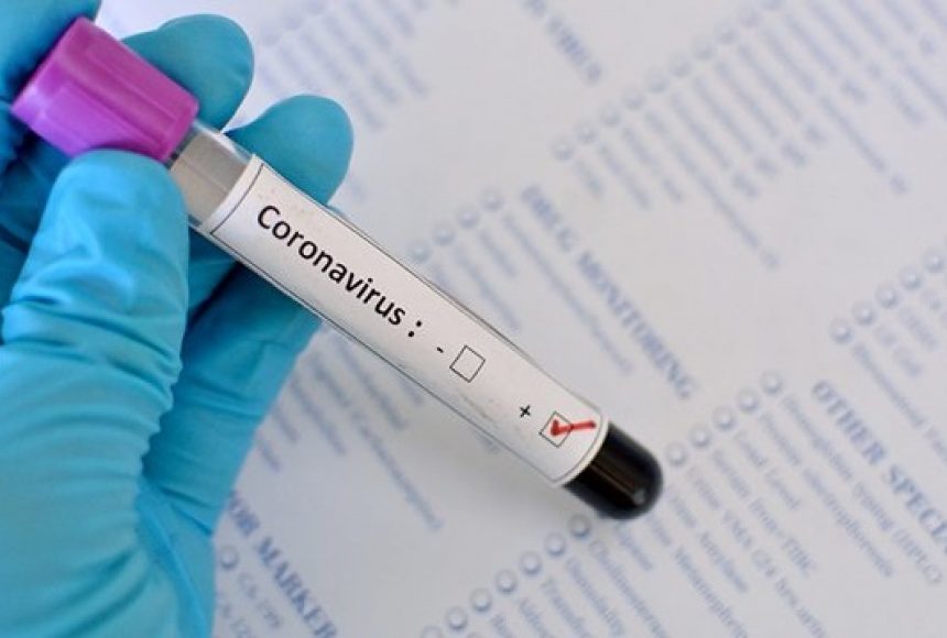 В Николаеве у 11 пациентов экспресс-тесты на коронавирус были  положительные: случаи не подтвердились | СВІДОК.info